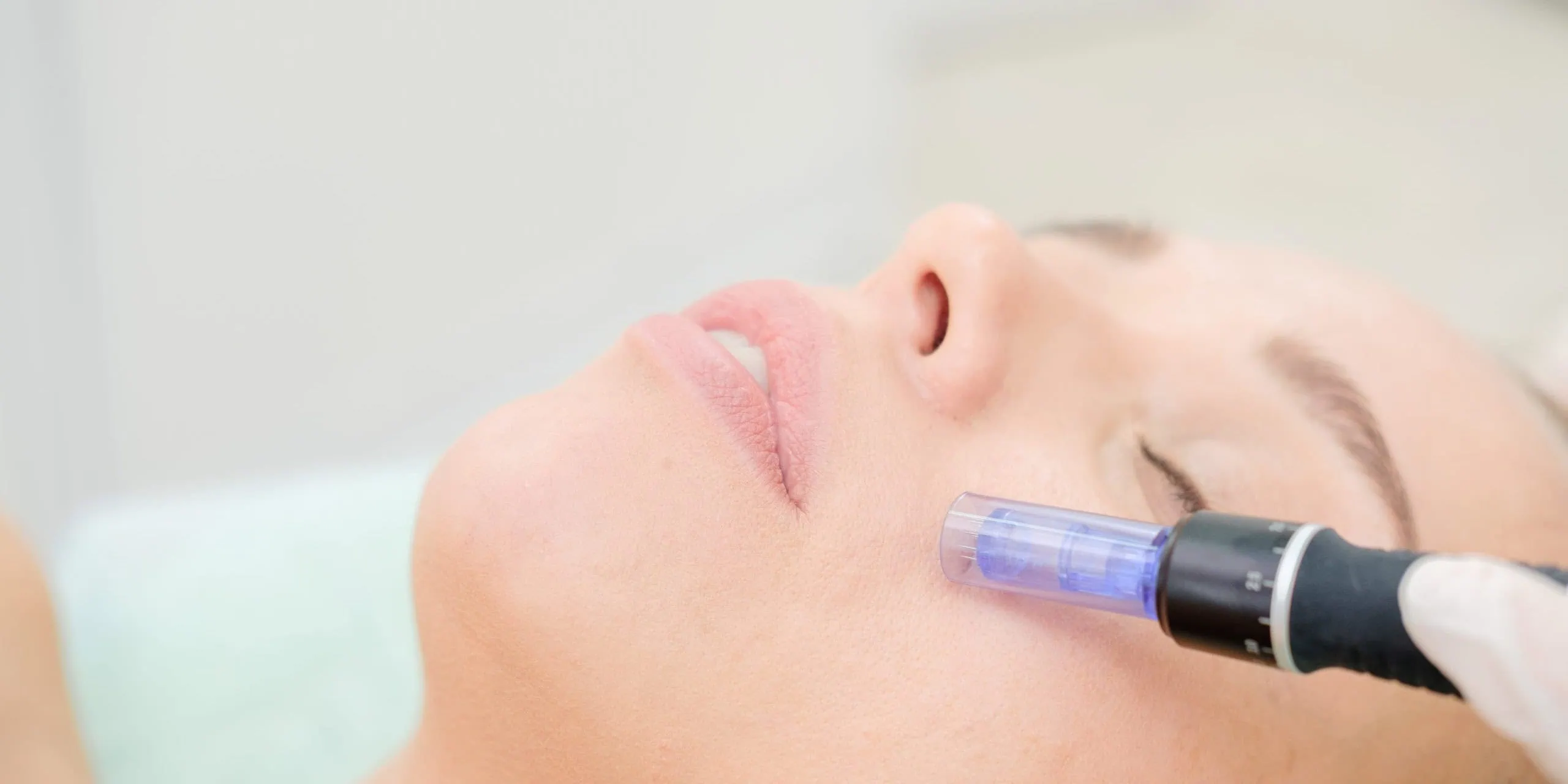 What is Dermapen Treatment and How it Works?