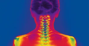 A thermography scan of female back showing full spine and joint inflammation in Santee, CA