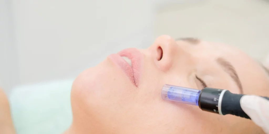 What is Dermapen Treatment and How it Works?